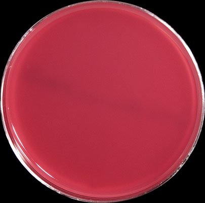 Columbia blood agar base